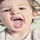 متخصص دندانپزشک کودکان کاشان |اختلاف رویشی دندان های مشابه در کودکان