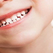 متخصص دندانپزشک کودکان کاشان| قطره آهن کودکان