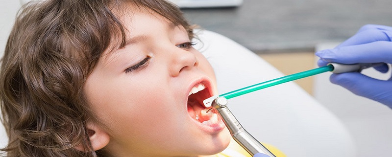 روشهای ترمیم دندان شیری کودکان | متخصص دندانپزشک کودکان کاشان