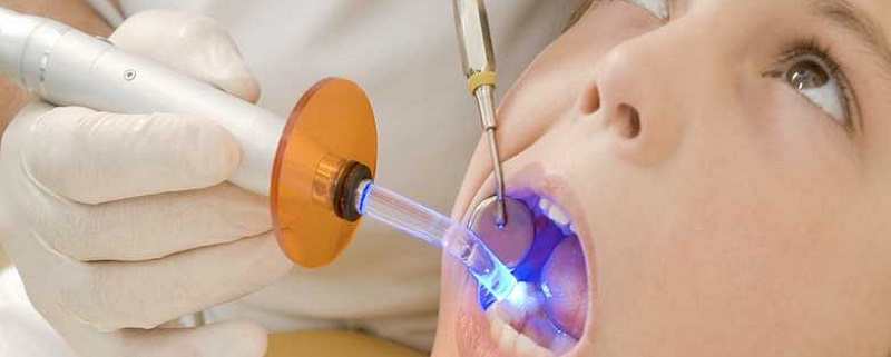 کاربرد لیزر در دندانپزشکی(قسمت سوم) | متخصص دندانپزشک کودکان کاشان