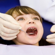 مزایای فیشورسیلانت یا شیاربندی دندان چیست؟ | متخصص دندانپزشک کودکان کاشان
