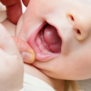 متخصص دندانپزشک کودکان کاشان | رویش دندان و حفظ بهداشت دندان