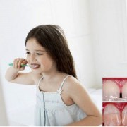 فلوروزیس دندانی | متخصص دندانپزشک کودکان کاشان
