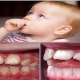 روش ترک عادات دهانی در کودکان | متخصص دندانپزشک کودکان کاشان