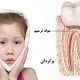 التهاب بعد از عصب کشی در کودکان | متخصص دندانپزشک کودکان کاشان