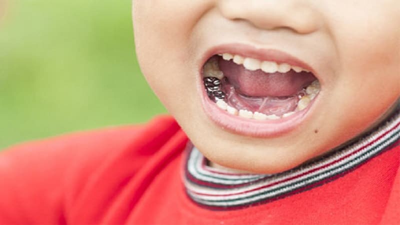 اهمیت درمان عصب‌کشی کودکان | متخصص دندانپزشک کودکان کاشان