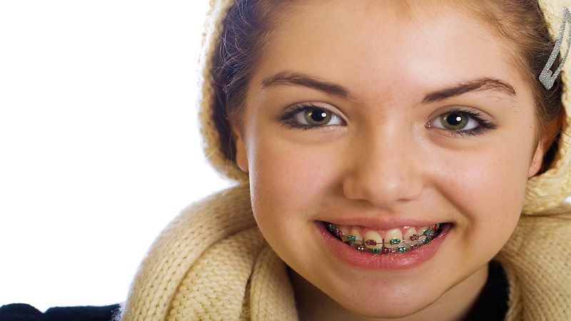 تاثیر دندان کج و نامتناسب بر سلامت عمومی کودک | متخصص دندانپزشک کودکان کاشان