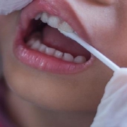 فلوراید تراپی جهت پیشگیری از پوسیدگی دندان | متخصص دندانپزشک کودکان کاشان