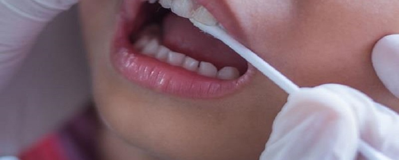 فلوراید تراپی جهت پیشگیری از پوسیدگی دندان | متخصص دندانپزشک کودکان کاشان