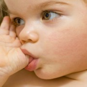 اثرات مکیدن انگشت شست در کودکان | متخصص دندانپزشک کودکان کاشان