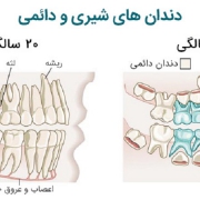 تفاوت پالپ دندان شیری و دائمی | متخصص دندانپزشک کودکان کاشان