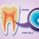 درمان پوسیدگی دندان با سلول های بنیادی | متخصص دندانپزشک کودکان کاشان