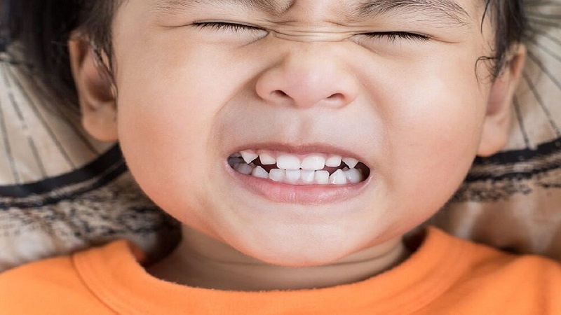 دندان قروچه در کودکان و روش های درمان | متخصص دندانپزشک کودکان کاشان