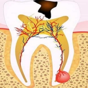 پالپ یا عصب چیست | متخصص دندانپزشک کودکان کاشان