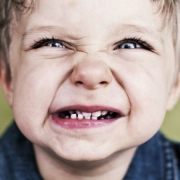 دندان قروچه یا براکسیسم در کودکان چیست | متخصص دندانپزشک کودکان کاشان