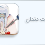 علل ایجاد کیست دندان | متخصص دندانپزشک کودکان کاشان