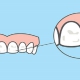 انواع لکه های دندان و درمان آن | متخصص دندانپزشک کودکان کاشان