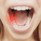 علت و درمان دندان درد در شبانه | متخصص دندانپزشک کودکان کاشان