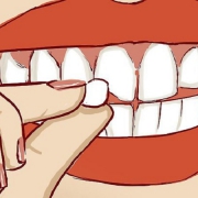 نکاتی در مورد شکستگی دندان | متخصص دندانپزشک کودکان کاشان