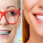 ارتودنسی بهتر است یا لمینت دندان؟ | متخصص دندانپزشک کودکان کاشان