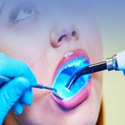 کشیدن دندان با لیزر | متخصص دندانپزشک کودکان کاشان