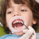 وارنیش فلوراید دندان کودکان و بزرگسالان | متخصص دندانپزشک کودکان کاشان