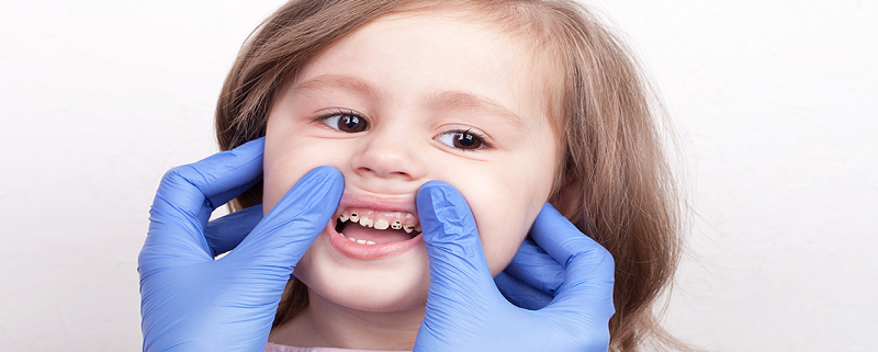 پیشگیری از بیماری های دندان در کودکان | متخصص دندانپزشک کودکان کاشان