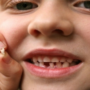 مشکلات رویش دندان های شیری و دائمی | متخصص دندانپزشک کودکان کاشان