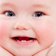 تغییر رنگ دندان در نوزادان | متخصص دندانپزشک کودکان کاشان