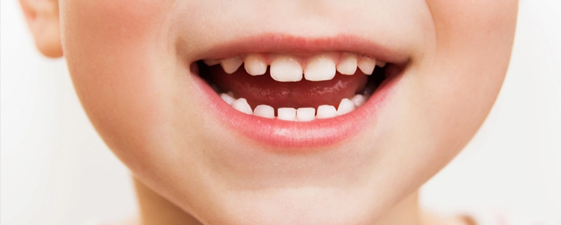 تکامل دندان های شیری | متخصص دندانپزشک کودکان کاشان