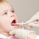 علائم تغییر رنگ دندان‌ها در کودکان | متخصص دندانپزشک کودکان کاشان