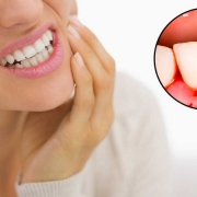 علل و درمان التهاب دندان عصب کشی شده | متخصص دندانپزشک کودکان کاشان