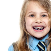 انواع مختلف ارتودنسی کودکان | متخصص دندانپزشک کودکان کاشان