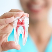 علل عصب کشی مجدد دندان | متخصص دندانپزشک کودکان کاشان
