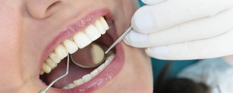 روش های درمان شل شدن دندان های بزرگسال | متخصص دندانپزشک کودکان کاشان