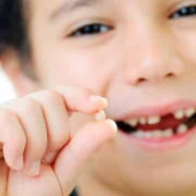 علل شایع لق شدن دندان ها | متخصص دندانپزشک کودکان کاشان