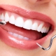 روش های درمان پری کورونیت چیست؟ | متخصص دندانپزشک کودکان کاشان