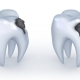 علت سیاه شدن داخل دندان شکسته چیست؟ | متخصص دندانپزشک کودکان کاشان