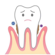 پوسیدگی و کرم‌خوردگی دندان | متخصص دندانپزشک کودکان کاشان