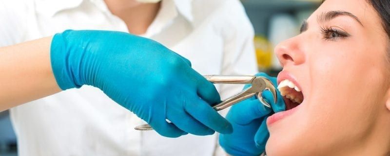 بررسی ابزارهای مورد استفاده در کشیدن دندان | متخصص دندانپزشک کودکان کاشان