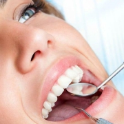 سوالات متداول مقایسه بلیچینگ با جرمگیری دندان | متخصص دندانپزشک کودکان کاشان