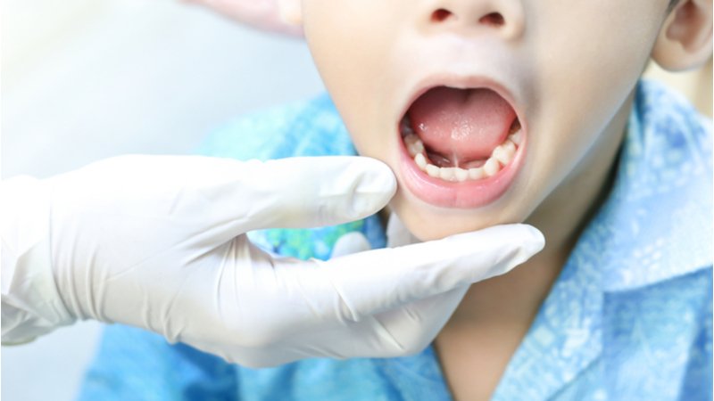 آسیب های ناشی از تروما در کودکان | متخصص دندانپزشک کودکان کاشان