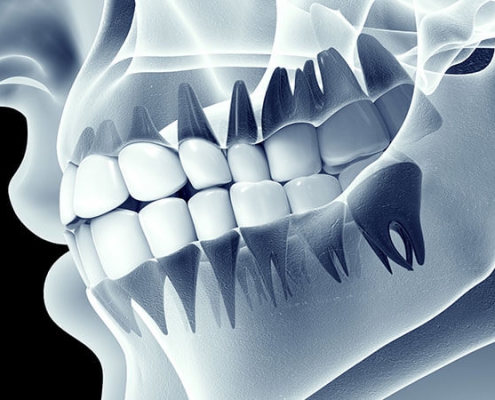 بررسی انواع رایج ترومای دندان | متخصص دندانپزشک کودکان کاشان