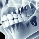 بررسی انواع رایج ترومای دندان | متخصص دندانپزشک کودکان کاشان