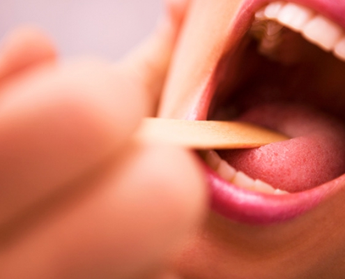 علل اصلی درد زبان و گلو | متخصص دندانپزشک کودکان کاشان